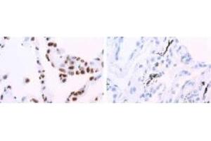 Image no. 3 for anti-Heterogeneous Nuclear Ribonucleoprotein A1 (HNRNPA1) antibody (ABIN108610) (HNRNPA1 抗体)