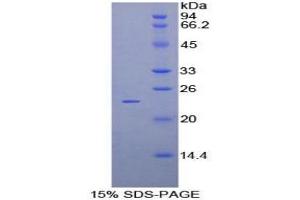 SDS-PAGE analysis of Mouse Protocadherin beta 2 Protein. (PCDHb2 蛋白)