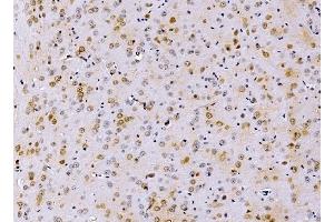 IHC analysis of PSMD8 using anti-PSMD8 antibody (ABIN7602571).