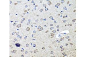 Immunohistochemistry of paraffin-embedded Mouse brain using CHRNB2 Polyclonal Antibody at dilution of 1:100 (40x lens). (CHRNB2 抗体)