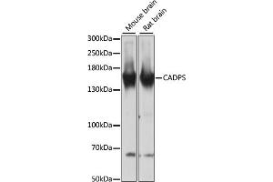 Western blot analysis of extracts of various cell lines, using CADPS antibody (ABIN6131298, ABIN6137843, ABIN6137844 and ABIN6217089) at 1:3000 dilution. (CADPS 抗体  (AA 1020-1100))