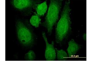 Immunofluorescence of monoclonal antibody to RAB3A on HeLa cell. (RAB3A 抗体  (AA 122-220))