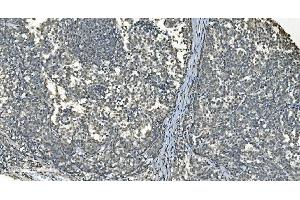 IHC analysis of LSM8 using anti-LSM8 antibody (ABIN7599579). (NAA38 抗体  (AA 1-96))