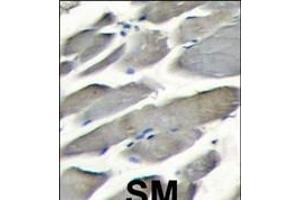 Formalin-fixed and paraffin-embedded skeletal muscle tissue reacted with PI3KCG antibody (Center) (ABIN392817 and ABIN2842248) , which was peroxidase-conjugated to the secondary antibody, followed by DAB staining. (PIK3 gamma 抗体  (AA 518-547))