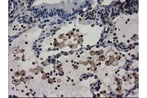 Immunohistochemical staining of paraffin-embedded Human Kidney tissue using anti-ADSL mouse monoclonal antibody. (Adenylosuccinate Lyase 抗体)