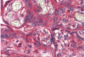 Immunohistochemistry (IHC) image for anti-Olfactory Receptor, Family 51, Subfamily E, Member 1 (OR51E1) (Internal Region) antibody (ABIN1049182)