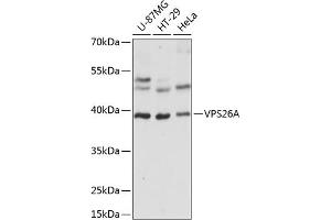 Western blot analysis of extracts of various cell lines, using VPS26A antibody  at 1:1000 dilution. (VPS26A 抗体  (AA 208-327))