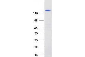 Western Blotting (WB) image for Zinc Finger and BTB Domain-Containing Protein 10 (ZBTB10) (Transcript Variant 1) protein (Myc-DYKDDDDK Tag) (ABIN2735770)