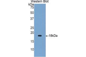 Western blot analysis of the recombinant protein. (Gastrokine 1 抗体  (AA 53-192))