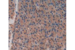 Used in DAB staining on fromalin fixed paraffin- embedded stomach tissue (XRN1 抗体  (AA 1567-1723))