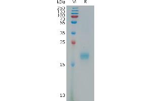 Interleukin 17F (IL17F) (AA 31-163) protein (His tag)