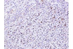 IHC-P Image Immunohistochemical analysis of paraffin-embedded SAS xenograft, using KRR1, antibody at 1:500 dilution. (KRR1 抗体)