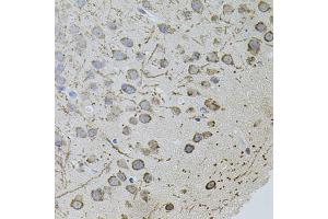 Immunohistochemistry of paraffin-embedded mouse brain using AR antibody (ABIN5971084) (40x lens). (Androgen Receptor 抗体)
