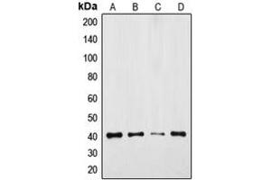 Western blot analysis of GPR175 expression in DLD (A), Jurkat (B), mouse colon (C), rat colon (D) whole cell lysates. (GPR175 抗体  (Center))