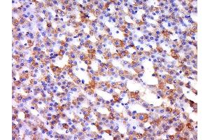 Paraformaldehyde-fixed, paraffin embedded rat adrendal gland, Antigen retrieval by boiling in sodium citrate buffer (pH6) for 15min, Block endogenous peroxidase by 3% hydrogen peroxide for 30 minutes, Blocking buffer (normal goat serum) at 37°C for 20min, Antibody incubation with 	Rabbit Anti-Integrin alpha L/CD11a Polyclonal Antibody, Unconjugated  at 1:500 overnight at 4°C, followed by a conjugated secondary and DAB staining. (ITGAL 抗体  (AA 251-350))