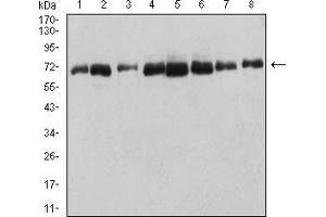 Western blot analysis using DDX5 mouse mAb against HT-29 (1), Hela (2), NIH/3T3 (3), COS7 (4), SW620 (5), Jurkat (6), A431 (7), and MCF-7 (8) cell lysate. (DDX5 抗体  (AA 475-614))