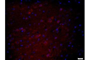 Paraformaldehyde-fixed, paraffin embedded mouse brain tissue, Antigen retrieval by boiling in sodium citrate buffer(pH6) for 15min, Block endogenous peroxidase by 3% hydrogen peroxide for 30 minutes, Blocking buffer (normal goat serum) at 37°C for 20min, Antibody incubation with Rabbit Anti-HEG1 Polyclonal Antibody, Unconjugated  at 1:400 overnight at 4°C, followed by a biotin conjugated secondary for 20 minutes at 37°C, followed by a conjugated streptavidin -Cy3) at 1:500 for 40 minutes and DAPI staining of the nuclei (HEG1 抗体  (AA 1151-1381))
