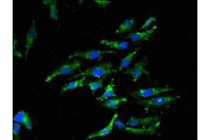 Immunofluorescent analysis of Hela cells using ABIN7156146 at dilution of 1:100 and Alexa Fluor 488-congugated AffiniPure Goat Anti-Rabbit IgG(H+L) (Caspase 12 抗体  (AA 61-282))