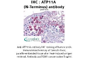 Image no. 1 for anti-ATPase, Class VI, Type 11A (ATP11A) (N-Term) antibody (ABIN1732072) (ATP11A 抗体  (N-Term))
