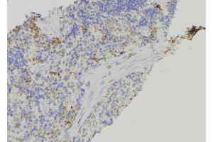 ABIN6278924 at 1/100 staining Human lymph node tissue by IHC-P. (Keratin 3 抗体  (C-Term))