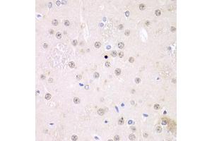 Immunohistochemistry of paraffin-embedded rat brain using FMRP Antibody (ABIN6127908, ABIN6140718, ABIN6140720 and ABIN6221284) at dilution of 1:100 (40x lens). (FMR1 抗体  (AA 1-290))