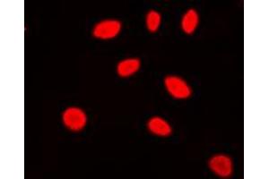 Immunofluorescent analysis of ZNF174 staining in Jurkat cells.