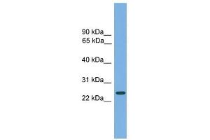 CHMP4B antibody used at 1 ug/ml to detect target protein. (CHMP4B 抗体  (Middle Region))