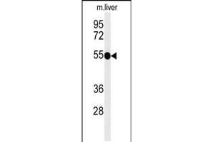 Western blot analysis of TNFRSF8-Y479 in mouse liver tissue lysates (35ug/lane) (TNFRSF8 抗体  (AA 458-487))