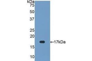 Detection of Recombinant SOD1, Human using Polyclonal Antibody to Superoxide Dismutase 1 (SOD1) (SOD1 抗体  (AA 2-154))