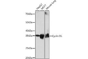 Western blot analysis of extracts of various cell lines, using Cyclin D1 antibody (ABIN7266561) at 1:1000 dilution. (Cyclin D1 抗体)