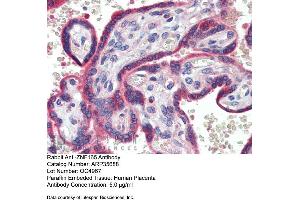 Immunohistochemistry with Human Placenta lysate tissue at an antibody concentration of 5. (ZNF165 抗体  (Middle Region))