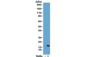 Western blot of acid extracts from HeLa cells untreated (-) or treated (+) with sodium butyrate using recombinant H3K36ac antibody at 1 ug/ml showed a band of Histone H3 acetylated at Lysine 36 in treated HeLa cells. (Recombinant Histone 3 抗体  (acLys36))
