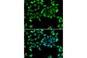 Immunofluorescence analysis of U2OS cells using EIF3H antibody. (EIF3H 抗体)