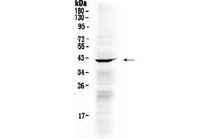 Western blot analysis of NDRG3 using anti- NDRG3 antibody . (NDRG3 抗体  (AA 181-239))