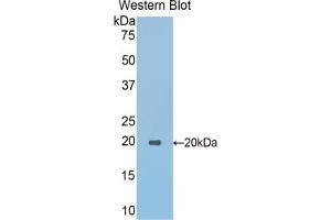 Detection of Recombinant SPTAN1, Mouse using Polyclonal Antibody to Alpha-Fodrin (SPTAN1) (SPTAN1 抗体  (AA 1049-1207))