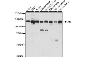 Western blot analysis of extracts of various cell lines, using IPO11 antibody. (Importin 11 抗体)