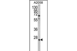 Western blot analysis of GRB2 Antibody (Center) (ABIN390238 and ABIN2840708) in  cell line lysates (35 μg/lane). (GRB2 抗体  (AA 89-118))