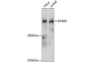 Western blot analysis of extracts of various cell lines, using EP400 antibody. (EP400 抗体)