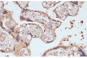 Immunohistochemistry of paraffin-embedded Human placenta using MYCBP Polyclonal Antibody at dilution of 1:100 (40x lens). (MYCBP 抗体)