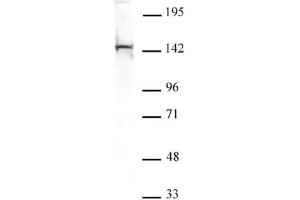 PGC1-β antibody tested by Western blot. (PPARGC1B 抗体  (N-Term))