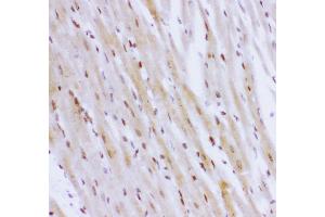 Anti- NR3C1 antibody,IHC(P) IHC(P): Rat Cardiac Muscle Tissue (Glucocorticoid Receptor 抗体  (AA 1-373))