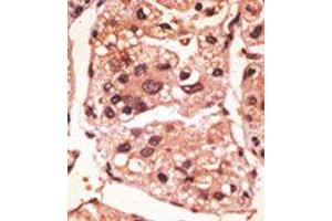 Image no. 1 for anti-Presenilin 1 (PSEN1) (C-Term) antibody (ABIN358721) (Presenilin 1 抗体  (C-Term))