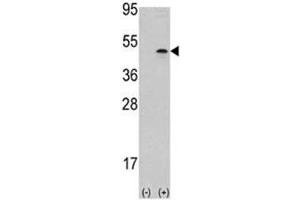 Western blot analysis of Aurora B antibody and 293 cell lysate (2 ug/lane) either nontransfected (Lane 1) or transiently transfected with the AURKB gene (2). (Aurora Kinase B 抗体  (AA 283-313))