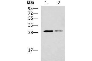 Western blot analysis of Mouse liver tissue and Mouse skeletal muscle tissue lysates using POMC Polyclonal Antibody at dilution of 1:800 (POMC 抗体)