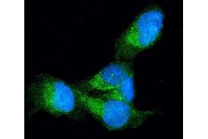 IF analysis of Profilin 1 using anti-Profilin 1 antibody (ABIN3043603).