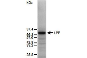 Westen blot of total human skin fibroblast proteins using anti-Lipoma Preferred Partner, pAb (IG-817) . (LPP 抗体  (AA 1-109))
