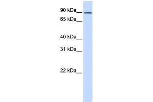 WB Suggested Anti-C2orf3 Antibody Titration: 0. (GCFC2 抗体  (N-Term))
