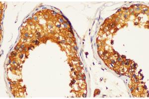 Immunohistochemistry of paraffin-embedded Human testis using LDHC Polycloanl Antibody at dilution of 1:200 (Lactate Dehydrogenase C 抗体)
