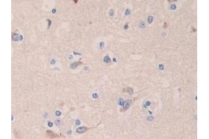 Immunohistochemistry (IHC) image for anti-Angiopoietin-Like 4 (ANGPTL4) (AA 182-388) antibody (ABIN7433018)