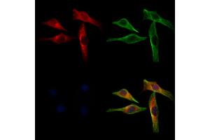 ABIN6262942 and ABIN6272945 staining 3 by IF/ICC. (LDHB 抗体  (N-Term))